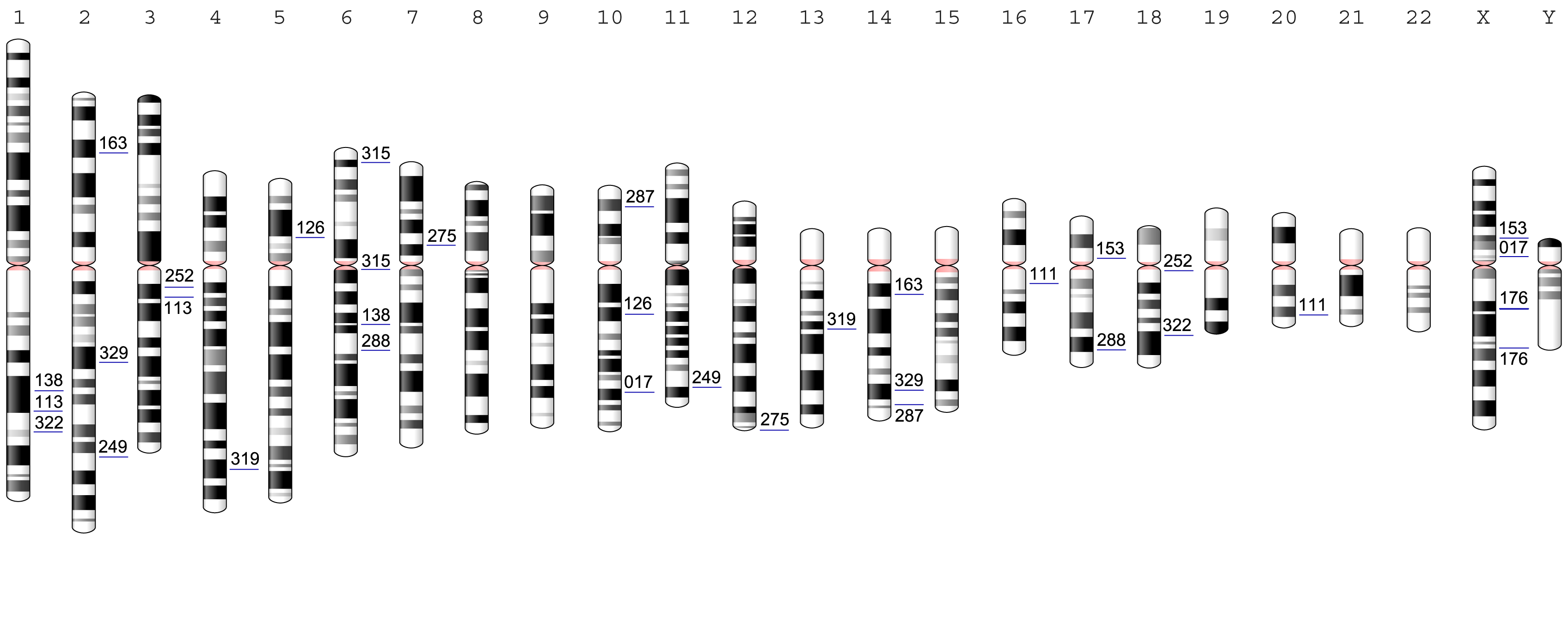 Chromosome locations of the 17 analyzed DGAP cases with non-coding BCAs. Breakpoint positions are marked with a blue line and the corresponding DGAP number. All chromosomes are aligned by the centromere (marked in pink) and are indicated above by their corresponding chromosome number.